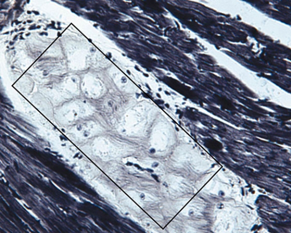 <strong>The cells located within the rectangle  </strong> A) are modified smooth muscle cells B) are modified skeletal muscle cells C) function in contraction D) function in impulse transmission E) function in glucose transport <div style=padding-top: 35px> 