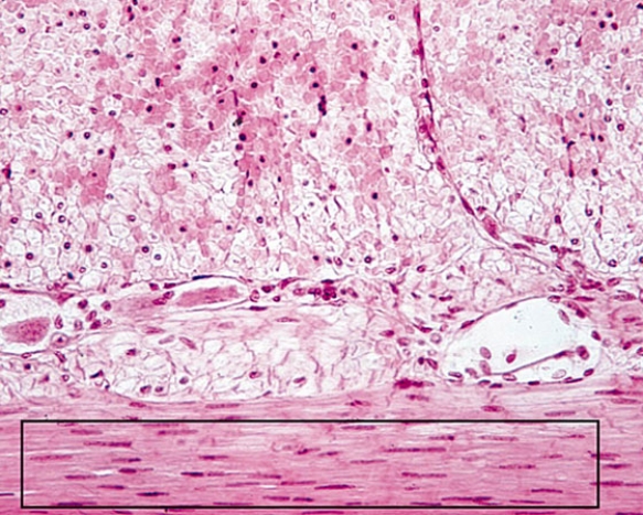 <strong>Identify the tissue within the rectangle  </strong> A) dense regular collagenous connective tissue B) dense regular elastic connective tissue C) skeletal muscle D) cardiac muscle E) smooth muscle <div style=padding-top: 35px> 