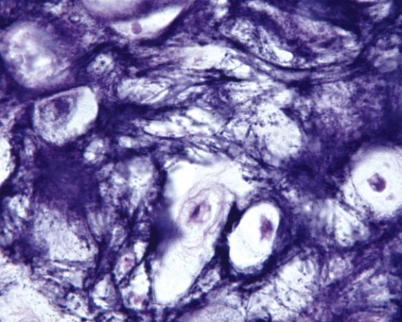 <strong>In Fig. Img_011, a patient presents with a nodule in his oral cavity/oral pharynx. The photomicrograph shows the normal area of his biopsy. The structure housing the nodule is the  </strong> A) uvula B) hard palate C) soft palate D) epiglottis E) palatine tonsil <div style=padding-top: 35px> 