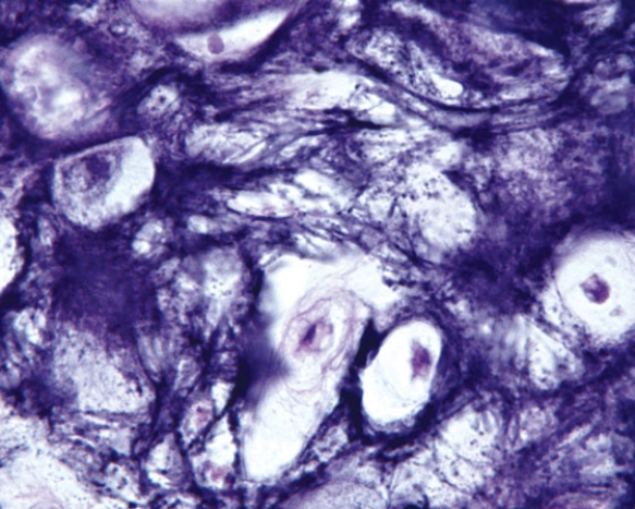 <strong>In Fig. Img_011a, the predominant fiber types in this light micrograph are elastic fibers and  </strong> A) type I collagen B) type II collagen C) type III collagen D) type IV collagen E) type V collagen <div style=padding-top: 35px> 