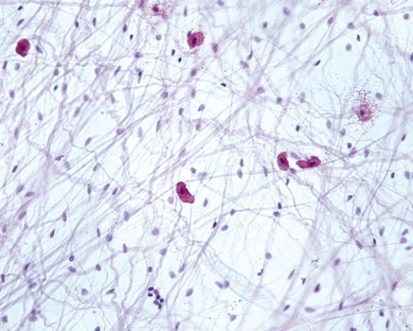 <strong>In Fig. Img_012, classify the tissue presented in the accompanying photomicrograph.  </strong> A) dense regular collagenous connective tissue B) dense irregular collagenous connective tissue C) loose connective tissue D) dense regular elastic connective tissue E) mucoid connective tissue <div style=padding-top: 35px> 
