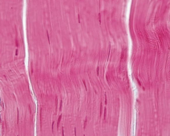 <strong>In Fig. Img_015, a patient enters the emergency department after she fell. The emergency department physician determined that she tore a tissue in her leg. The following photomicrograph shows the torn tissue. What did this patient tear?  </strong> A) dermis of the skin B) epidermis of the skin C) ligamentum nuchae D) tendon E) peripheral nerve bundle <div style=padding-top: 35px> 