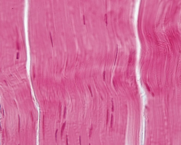 <strong>In Fig. Img_015a, a patient enters the emergency department after she fell. The emergency department physician determined that she tore a tissue in her leg. The following photomicrograph shows the torn tissue. Identify the cells whose nuclei are visible in this photomicrograph.</strong> A) fibroblasts   B) Schwann cells C) smooth muscle cells D) mesenchymal cells E) macrophages <div style=padding-top: 35px> 