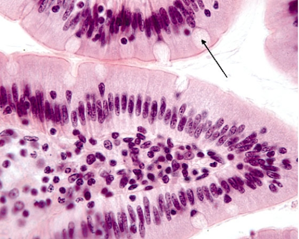 <strong>In Fig. Img_005, the cell at the tip of the pointer manufactures and releases  </strong> A) mucinogen B) mucinase C) mucus D) mucilage E) mucin <div style=padding-top: 35px> 
