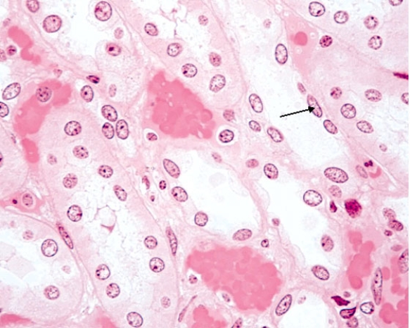 <strong>In Fig. Img_008, the tissue at the tip of the pointer is classified as  </strong> A) stratified squamous epithelium B) loose connective tissue C) dense irregular collagenous connective tissue D) simple squamous epithelium E) stratified cuboidal epithelium <div style=padding-top: 35px> 