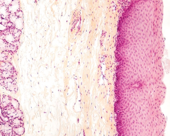 <strong>In Fig. Img_018, the epithelium lining the lumen of this organ is classified as  </strong> A) simple squamous B) simple cuboidal C) stratified squamous nonkeratinized D) stratified cuboidal E) transitional <div style=padding-top: 35px> 