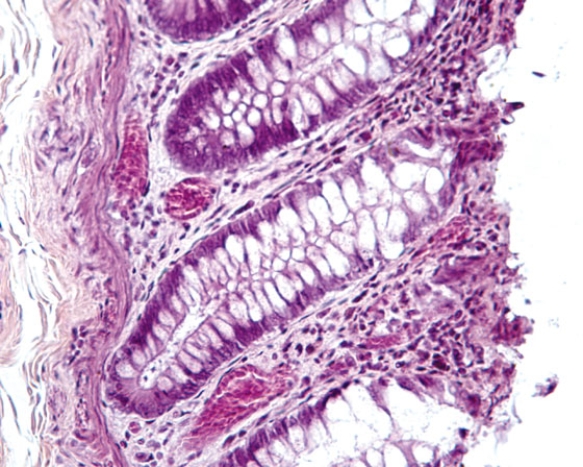 <strong>In Fig. Img_021, a large percentage of the epithelial cells of this organ appear to possess an empty region. In life, that region was filled with secretory granules housing  </strong> A) mucus B) mucinogen C) mucin D) trypsinogen E) trypsin <div style=padding-top: 35px> 