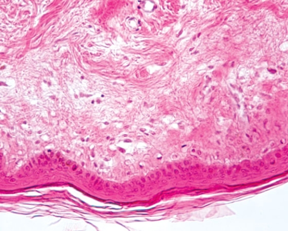 <strong>In Fig. Img_022, the epithelium at the free surface is classified as  </strong> A) simple squamous B) simple cuboidal C) stratified squamous keratinized D) stratified cuboidal E) transitional <div style=padding-top: 35px> 