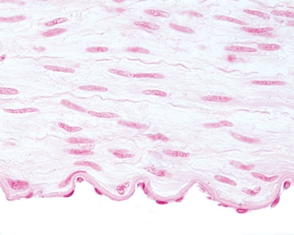 <strong>In Fig. Img_023, the epithelium at the free surface is classified as  </strong> A) simple squamous B) simple cuboidal C) stratified squamous keratinized D) stratified cuboidal E) transitional <div style=padding-top: 35px> 