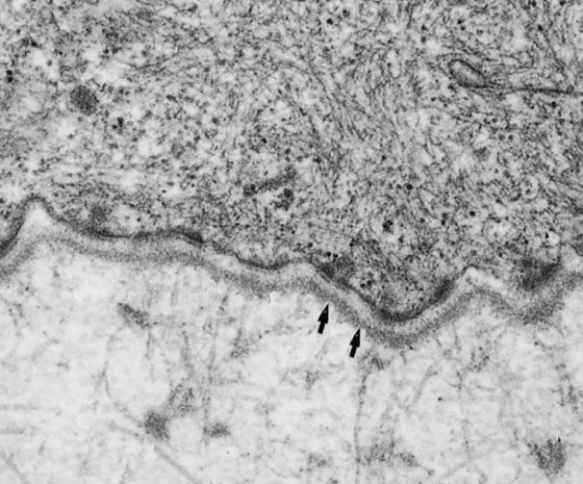 <strong>In Fig. Basallamina2, the arrow points to an area that is rich in </strong> A) type I collagen B) type II collagen C) type III collagen D) type IV collagen E) type VII collagen