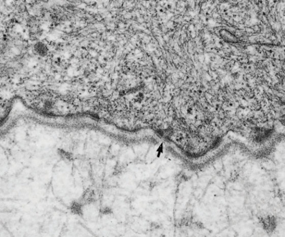 <strong>In Fig. Basallamina3, the clear area indicated by the tip of the arrow is rich in </strong> A) hyaluronic acid B) fibronectin C) laminin D) perlacans E) cadherins