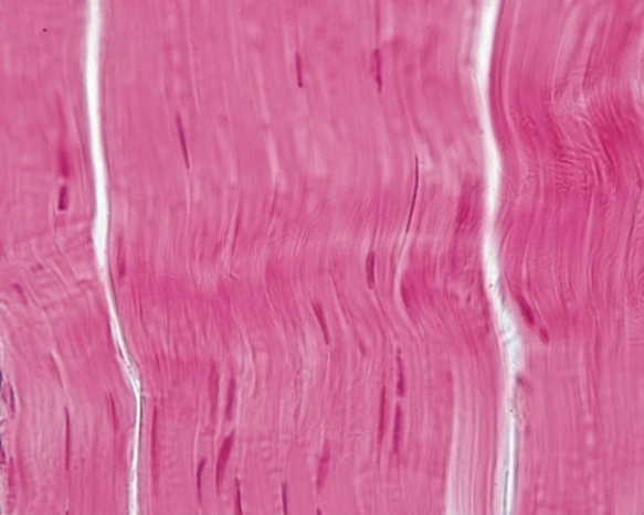 <strong>In Fig. Img_015b, which of the following familial disorders is due to abnormal development of the tissue shown in the accompanying photomicrograph? </strong> A) Marfan syndrome B) Beal's syndrome C) Ehler-Danlos syndrome D) cutis laxa E) Supraclavicular aortic stenosis syndrome