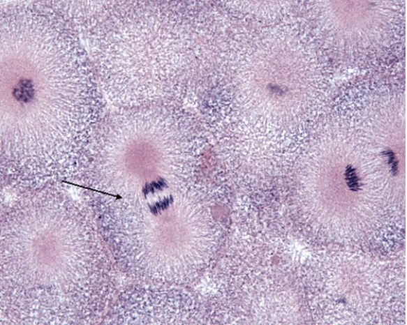 <strong>In Fig. Img_009, the cell at the tip of the pointer is in which of the following phases of mitosis? </strong> A) prophase B) prometaphase C) metaphase D) anaphase E) telophase