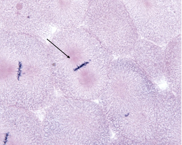 <strong>In Fig. Img_010, the cell at the tip of the pointer is in which of the following phases of mitosis? </strong> A) prophase B) prometaphase C) metaphase D) anaphase E) telophase