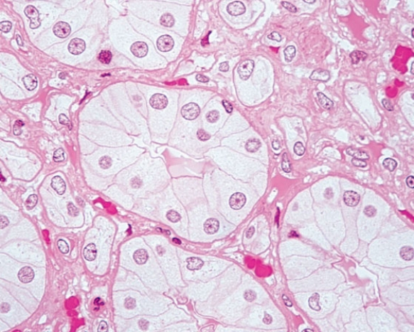 <strong>In Fig. Img_002, the collecting tubule of the kidney, water enters the lumen via  </strong> A) pinocytosis B) endocytosis C) aquaporins D) ion channels E) carrier proteins <div style=padding-top: 35px> 