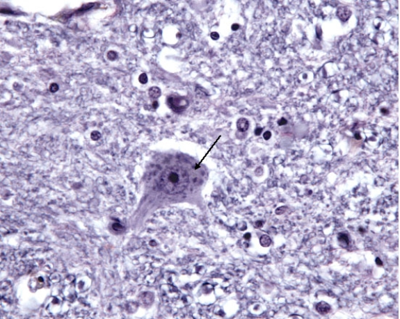 <strong>In Fig. Img_004, the structure at the tip of the arrow is responsible for which of the following?  </strong> A) synthesis of ATP B) assembly of microtubules C) assembly of neurofilaments D) synthesis of lysosomal proteins E) assembly of neurotubules <div style=padding-top: 35px> 