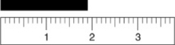 <strong>Given the following figure, which of the measurements listed is the best estimate of the length of the aluminum rod? </strong> A) 1.8 cm B) 1.81 cm C) 1.810 cm D) 1.9 cm E) 2 cm