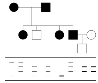 <strong>Below is a pedigree for a very rare,late-onset genetic condition.Below the pedigree are represented the RFLP banding patterns obtained for each individual in the family.The RFLP locus used is about 2 cM away from the gene responsible for the disease.Note that darker/thicker bands indicate homozygosity for that particular morph of the RFLP. What is the probability that the child in generation III will develop the disease?</strong> A)0% B)0.4% C)1% D)2% E)50%