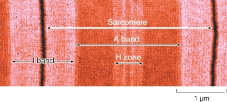 <strong>Refer to the figure below.Which statement accurately describes the H zone and I bands of a sarcomere? </strong> A) The H zone and I bands are regions of the sarcomere that appear light under the microscope because they both represent areas where myosin but not actin filaments are present. B) The H zone and I bands are the only regions of the sarcomere that do not shorten or lengthen as the sarcomere contracts. C) A shortening of the H zone is always accompanied by a shortening of the I bands,and a lengthening of the H zone is always accompanied by a lengthening of the I bands. D) Stimulation by an action potential results in a lengthening of the H zone but a shortening of the I bands. E) The H zone,but not the I bands,change in width during contraction of the sarcomere.