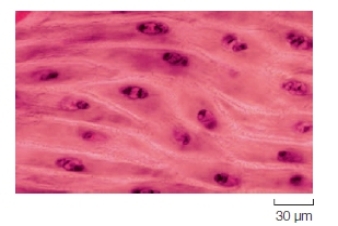 <strong>Which type of muscle cell is shown in the image below? </strong> A) Skeletal B) Cardiac C) Smooth D) Insect flight muscle E) Both a and d