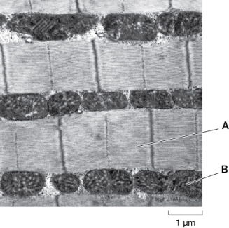<strong>The figure below shows an electron micrograph of a portion of one insect flight muscle cell.Identify the structures labeled A and B. </strong> A) A = actin and myosin filaments;B = gap junctions B) A = T tubules;B = sarcoplasm C) A = actin and myosin filaments;B = mitochondria D) A = T tubules;B = mitochondria E) A = sarcoplasm;B = gap junctions