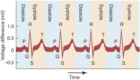 <strong>In the electrocardiogram (EKG)record of a normal cardiac cycle shown below,wave T corresponds to _______ of the _______. </strong> A) depolarization;atria B) depolarization;ventricles C) repolarization;atria D) repolarization;ventricles E) Both a and b