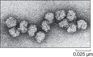 <strong>The figure below is an electron micrograph of _______.The picture could have been taken of cellular material from _______.  </strong> A) chloroplasts;a plant but not an animal B) ribosomes;an animal but not a plant C) mitochondria;a plant or animal D) ribosomes;a plant or animal E) the Golgi apparatus;a plant or animal <div style=padding-top: 35px> 