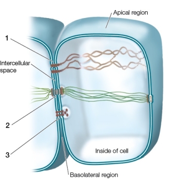 The figure below shows a cell that could have been taken from a _______;the structures labeled 1,2 and 3,are _______,_______ and _______,in that order.  
