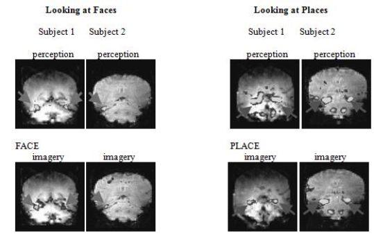 <strong>Shown here are the fMRIs of the brain activity in two participants whilethey looked at photographs of familiar faces and places (top row-perception) or imagined the same pictures (bottom row-imagery).According to the Focus on Neuroscience box, Seeing Faces and Places inthe Mind's Eye, what do these fMRIs demonstrate? </strong> A)The fusiform facial area is activated when either looking at familiar faces or imagining them, and the parahippocampal place area is activated when either looking at familiar places or imagining them. B)Totally different brain areas are active when participants look at objects (familiar faces or places) compared to when they imagine the same objects. C)There is virtually no brain activity in the fusiform facial area or the parahippocampal place area when participants are looking at familiar faces or places (perception) but very high levels when the participants are imagining familiar faces or places (imagery). D)There is a very high level of brain activity in the fusiform facial area and the parahippocampal place area when participants are looking at familiar faces or places (perception) but very low levels when the participants are imagining familiar faces or places (imagery).