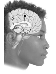 <strong>This image depicts key components involved in regulating your internal biological clock. Which structure manufactures melatonin? </strong> A)pineal gland B)suprachiasmatic nucleus C)optic nerve D)None of the answers is correct.