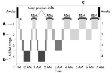 <strong> This image depicts the sleep cycles over the course of a typical night. In which stage does the brain become much more active,and heart rate, blood pressure, and respirations shift up and down, sometimes extremely? </strong> A)stage 1 NREM B)stage 2 NREM C)REM sleep D)stage 4 NREM