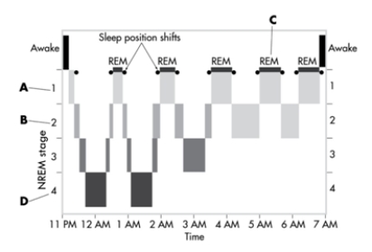 <strong>This image depicts the sleep cycles over the course of a typica lnight. In which stage are night terrors most likely to occur? </strong> A)stage 1 NREM B)stage 2 NREM C)REM sleep D)stage 4 NREM