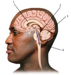 <strong>This cross section of the human brain depicts several key structures. Pick the alternative that correctly labels the structures in the drawing. </strong> A)1 = hypothalamus, 2 = nucleus, 3 = axon, 4 = myelin sheath B)1 = corpus callosum, 2 = pons, 3 = cerebellum, 4 = medulla C)1 = hippocampus, 2 = reticular formation, 3 = medulla, 4 = spinal cord D)1 = thalamus, 2 = hypothalamus, 3 = pons, 4 = brain stem