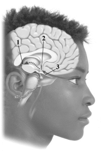 <strong>This image depicts three of the key components involved in regulating your internal biological clock. Pick the alternative that correctly labels the structures in the drawing. </strong> A)1 = pituitary gland, 2 = pineal gland, 3 = melatonin pathway B)1 = hypothalamus, 2 = optic chiasm, 3 = beta neural pathway C)1 = thalamus, 2 = circadian center, 3 = bipolar optic pathway D)1 = pineal gland, 2 = suprachiasmatic nucleus, 3 = optic nerve