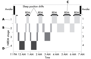 <strong>This image depicts the sleep cycles over the course of a typical night. In which stage does the brain become much more active, and heart rate, blood pressure, and respirations shift up and down, sometimes extremely? </strong> A)stage 1 NREM B)stage 2 NREM C)REM sleep D)stage 4 NREM