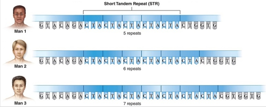 <strong>Examine this diagram of short tandem repeats found in DNA profiling of three suspects in a crime.Man 1 shares the same number of STRs as 1 in 5,000 people.Man 2 shares the same number of STRs as 1 in 10,000 people.Man 3 shares the same number of STRs as 1 in 3,500 people.DNA extracted from samples at the crime scene found 6 STR repeats,giving the interpretation that  </strong> A) it is more rare to have six STRs than five or seven. B) Man 2 must be guilty, based on this proof. C) STR numbers match Man 2. D) no conclusion can be made, because the STRs all repeat the same sequence of C-T-A. E) Man 2 is likely guilty, considering that he has a rare STR profile that matches crime scene samples. <div style=padding-top: 35px> 