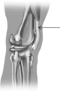 <strong>The structure that is highlighted in this illustration of a knee joint is a </strong> A)bone. B)ligament. C)tendon. D)synovial sac.