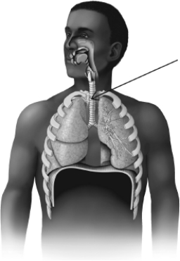 <strong>The structure that is highlighted in this figure is the </strong> A)diaphragm. B)bronchi. C)larynx. D)trachea.