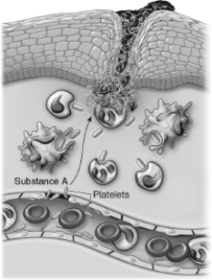 <strong>Substance A is likely to be which of the following? </strong> A)lymph B)blood C)lymphocytes D)pus