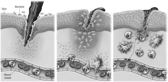 Based on the information provided in the figure, explain the events that occur during inflammation and blood clotting. In addition, label the following structures in the figure: neutrophil, platelet, macrophage, and cytokine.