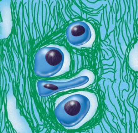 <strong>Where would you expect to find this tissue in the human body? </strong> A)In the blood B)Under the skin C)In between vertebrae D)Attached to bone