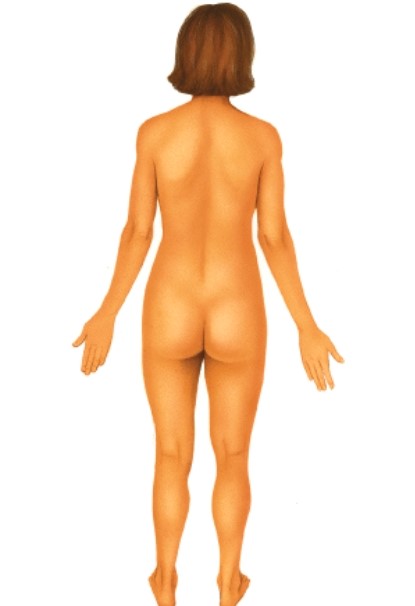 <strong>Describe the view of this body. </strong> A)Ventral B)Dorsal C)Lateral D)Medial