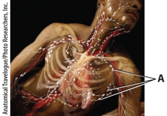 <strong>What is the name of the lymphatic structure A? </strong> A)thymus B)lymph node C)spleen D)tonsil