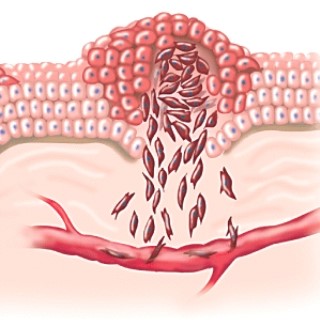 <strong>This process is called: </strong> A)angiogenesis. B)metastasis. C)apoptosis. D)oncogenesis.