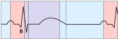 <strong>What is happening during the phase labeled B? </strong> A)Atrial depolarization B)Ventricular depolarization C)Ventricular repolarization D)AV valve closure