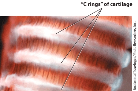 <strong>Identify this structure. </strong> A)Pharynx B)Esophagus C)Bronchi D)Trachea