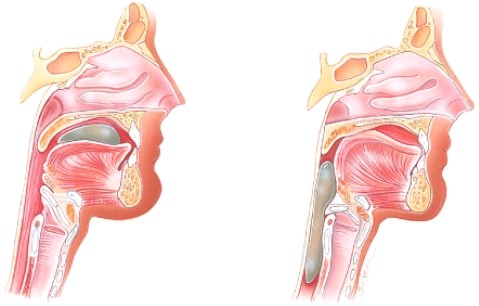 <strong>Which stage of swallowing is shown here?  </strong> A)Voluntary stage B)Pharyngeal stage C)Esophageal stage D)Pyloric stage <div style=padding-top: 35px> 