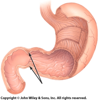 <strong>In the diagram,the arrow is pointing at the:  </strong> A)rugae sphincter. B)duodenal sphincter. C)esophageal sphincter. D)pyloric sphincter. <div style=padding-top: 35px> 