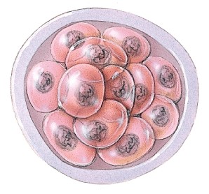 <strong>Approximately how many days old is this group of cells? </strong> A)1 B)2 C)4 D)7