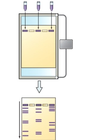 <strong>What is the name of the technique shown here? </strong> A)Karyotype B)Polymerase chain reaction C)Human genome project D)Restriction fragment length polymorphism